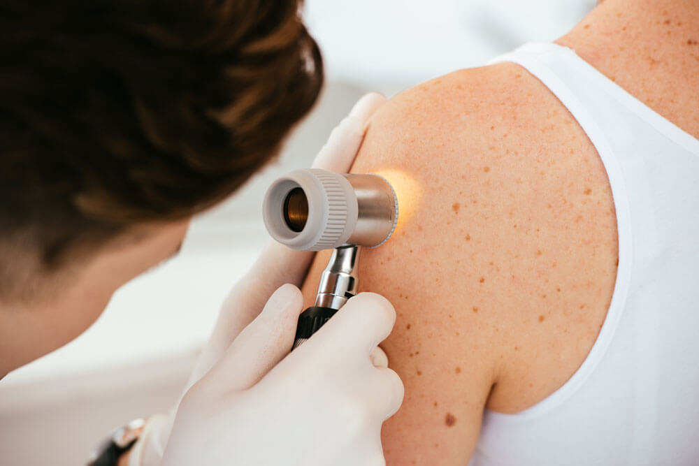 Skin care Doctors in Adyar