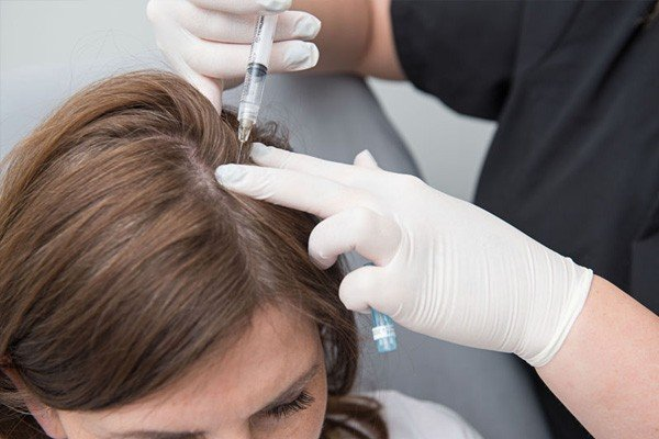 PRP Hair Loss Treatment In Adyar