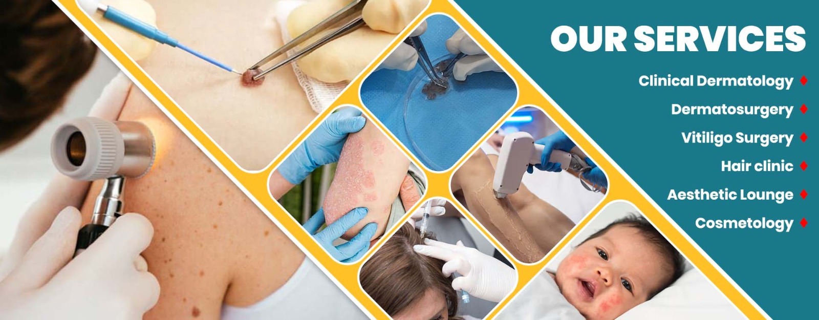 Skin Clinic in Adyar